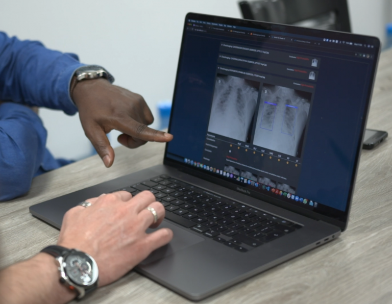 x-ray images on a laptop computer