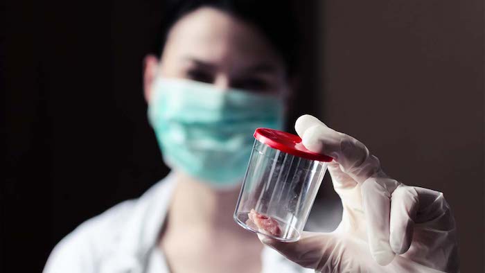 Masked and gloved Illumina scientist holding a biopsy sample in a sealed container.
