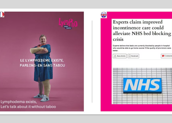 Lymphodema exists, Let&#039;s talk about it without taboo
