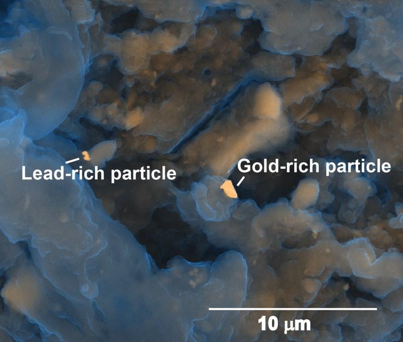 In-your-intestines-there-may-be-a-gold-or-silver-lining.jpg