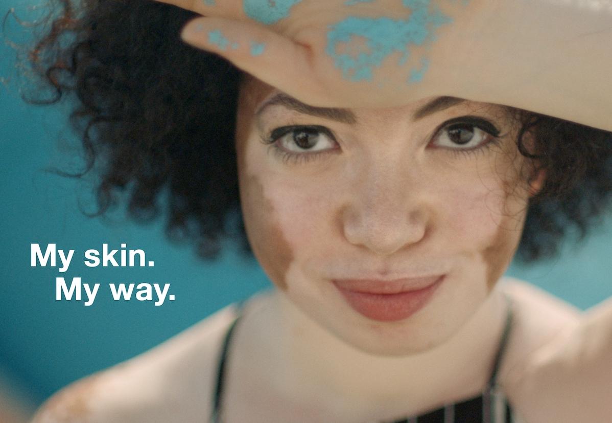my-skin-my-way.jpg